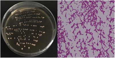 Preventive effect of Lacticaseibacillus rhamnosus 2016SWU.05.0601 and its postbiotic elements on dextran sodium sulfate-induced colitis in mice